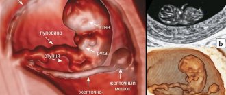 18th week of pregnancy: development and size of the fetus, what happens in the woman’s body
