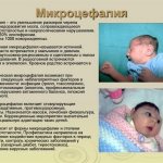 20 недель беременности размер плода фото узи мальчика