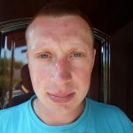 аллергия на солнце