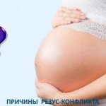 &#39;alt=&quot;Causes of Rhesus conflict&quot;&#39; width=&quot;600