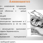 Amniocentesis during pregnancy. What is it, accuracy, when to do it, consequences, contraindications 