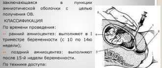 Амниоцентез при беременности. Что это такое, точность, на каком сроке делают, последствия, противопоказания