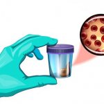 Анализ кала на скрытую кровь