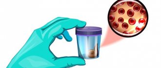 Fecal occult blood test