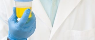 анализ мочи при гломерулонефрите