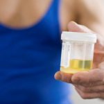 Анализ мочи