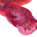 Анальные трещины могут появиться из-за хронического запора