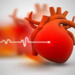 Arterial hypertension