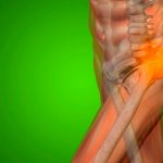 Боль в тазобедренном суставе