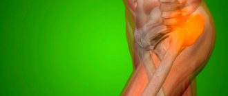 Hip pain