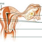 Lower back pain during pregnancy