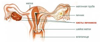 Lower back pain during pregnancy