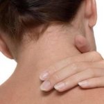 Боли в шее справа