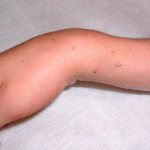 What is the characteristic of first aid for a broken shoulder? Let’s test the theory