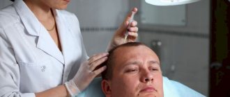 Itchy scalp