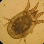 Чесоточный клещ под микроскопом