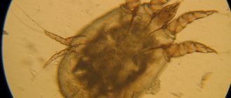 Scabies mite under a microscope