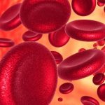 Что такое железодефицитная анемия?