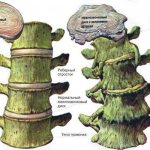 Spondylosis deformans of the thoracic spine