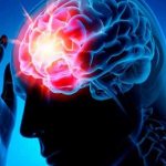 Диагностика эпилепсии