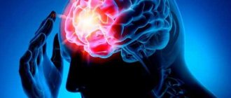 Diagnosis of epilepsy