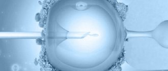 Экстракорпоральное оплодотворение