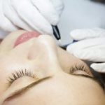 Электроэпиляция