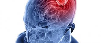 Encephalitis
