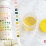 Red blood cells in the urine of a child: causes, normal, elevated