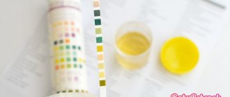 Red blood cells in the urine of a child: causes, normal, elevated