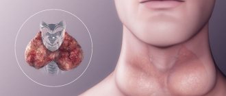 Эутиреоз щитовидной железы — что это такое, симптомы и лечение