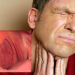 Фарингит у взрослых