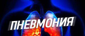 Фото легких при пневмонии