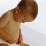 Photo: Signs of hydrocele in a child