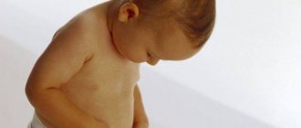 Фото:Признаки водянки яичка у ребенка