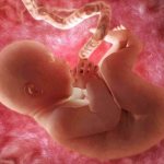 Photo: Ultrasound at 30 weeks of pregnancy