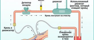 Гемодиализ: показания