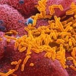 Гемофильная палочка