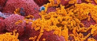 Haemophilus influenzae