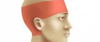 Головная боль напряжения