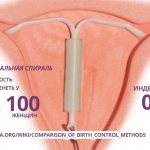 Гормональная спираль - вероятность забеременеть