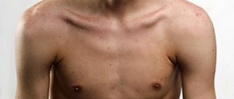 Breast