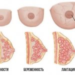 Breasts during pregnancy. Photo of changes, increased sensitivity, pain, decreased, itches, swells 