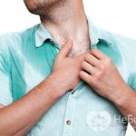 Характерным признаком патологии является избыточное выделение пота