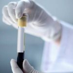 ХГЧ у небеременных женщин