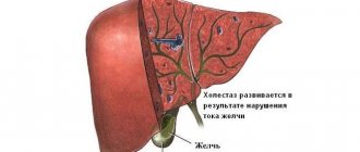 cholestasis in pregnancy