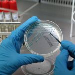 Хроническая патология желудочно-кишечного тракта: гастрит, гастро-дуоденит, язва двенадцатиперстной кишки диагностика