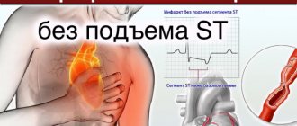 myocardial infarction without st elevation