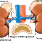 Changes in the adrenal glands during disease