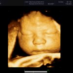 измерение линейных показателей